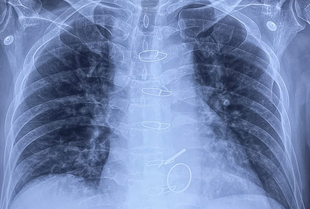 Doctors Warn College Drinking Has Dangers Most Parents Never Think to Ask About