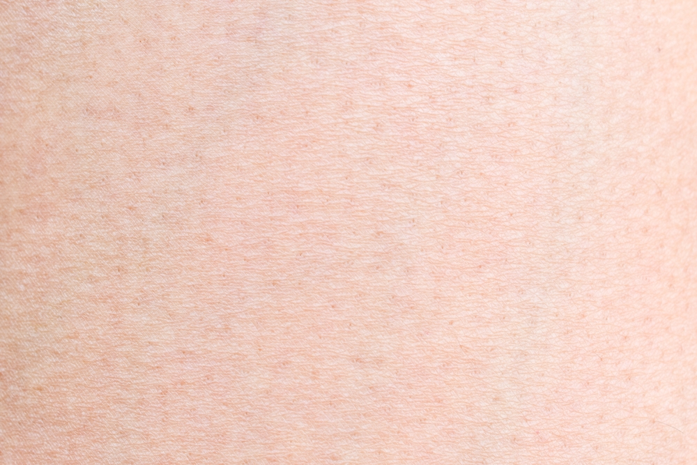 Texas Senate Candidate Told Fox News His White Skin Tweets Are Fine and You Can Probably Guess What Happened Next